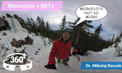 Microclots + NETs: the blood traffic jam behind Long COVID