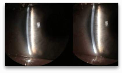 3D eye exam